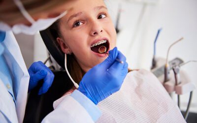 4 Reasons to Choose an Orthodontists over a Dentist
