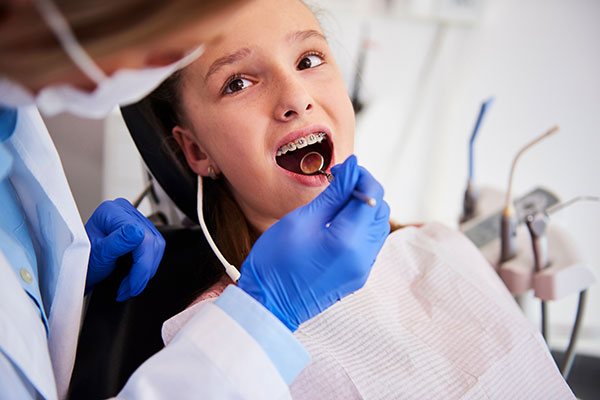 4 Reasons to Choose an Orthodontists over a Dentist