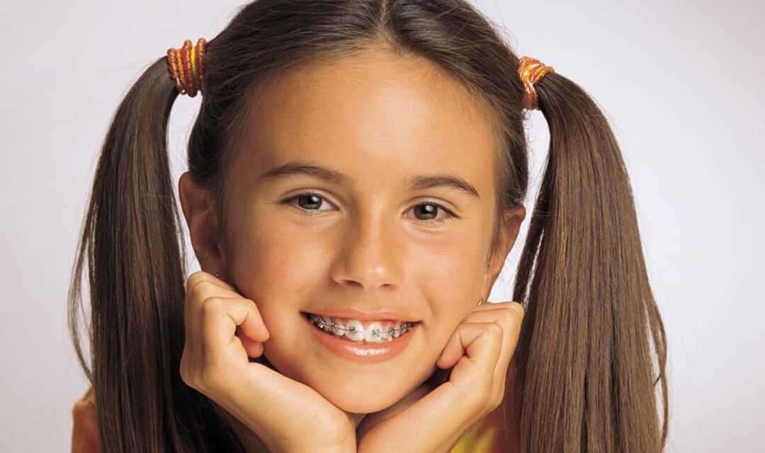 The Dental Benefits of Invisalign Orthodontic Treatment