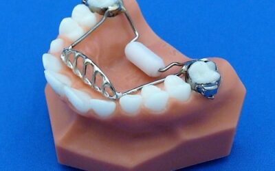 Why Choose an Orthodontist Over a Dentist for Your Braces Treatment