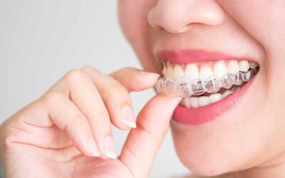 The Difference Between Invisalign and LightForce Braces